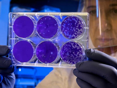 Grâce aux bactéries, ces chercheurs veulent produire de l'hydrogène vert à moindre coût